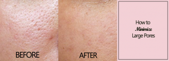 How to Minimize Large Pores